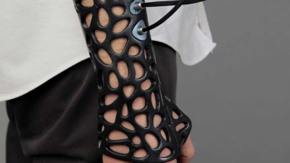 'A' Design Awards. Ultrasound could be the killer app that makes 3D printed casts take off