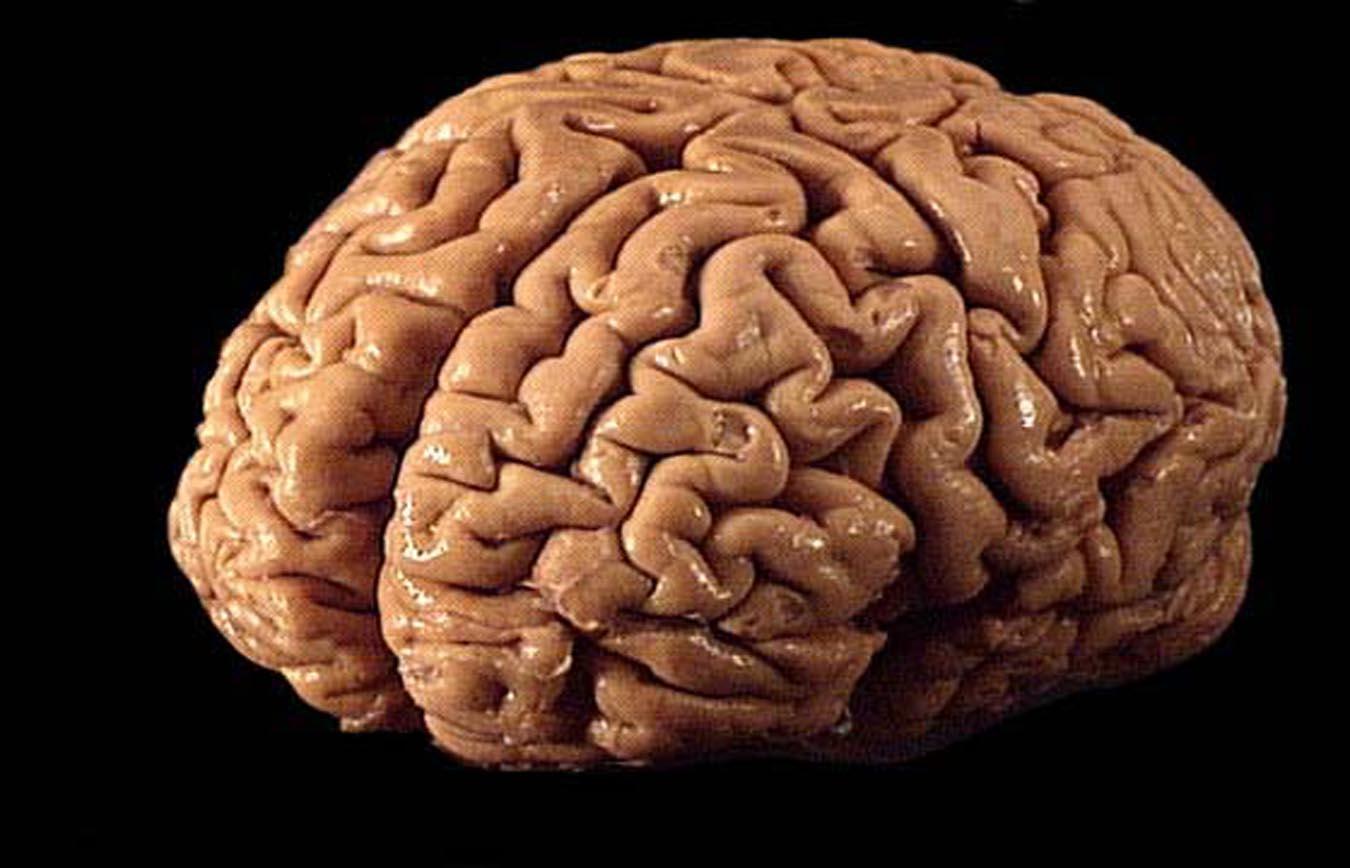 The human brain's walnut-like wrinkles give it more surface area | Wikimedia
