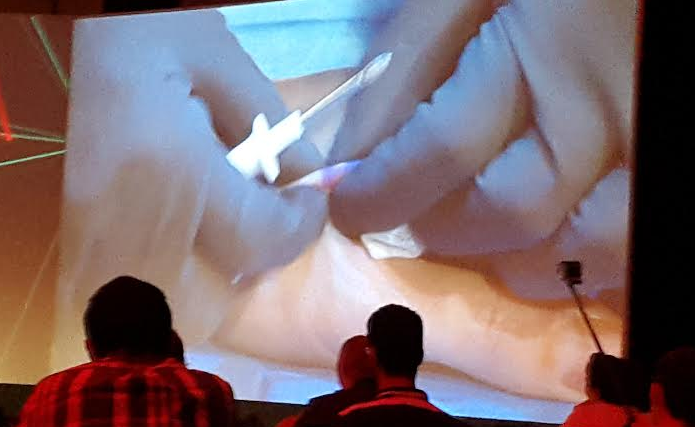 A volunteer at the summit having an NFC chip implant live on stage. | Charlie Osborne - ZDNet